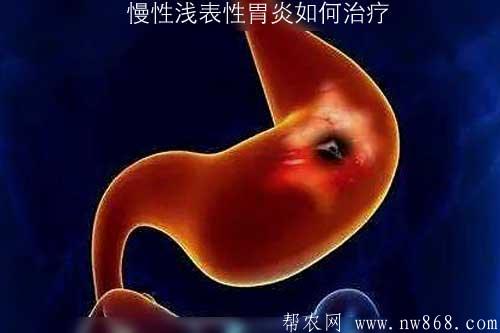 慢性淺表性胃炎如何治療